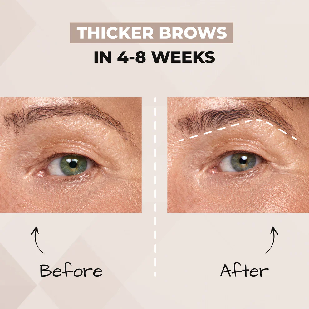 Brow Gel + Brow Serum - Image 10