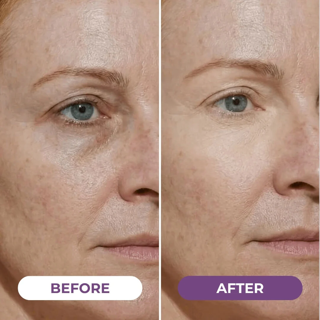 EyeCorrect+ Undereye Brightener - Image 4
