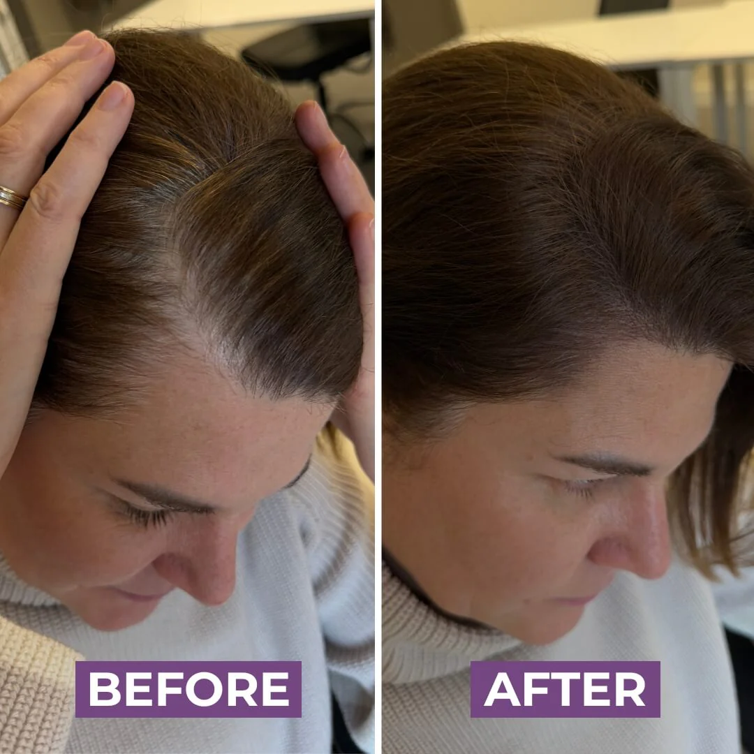 HairMagic+ Hairline Powder - Image 5