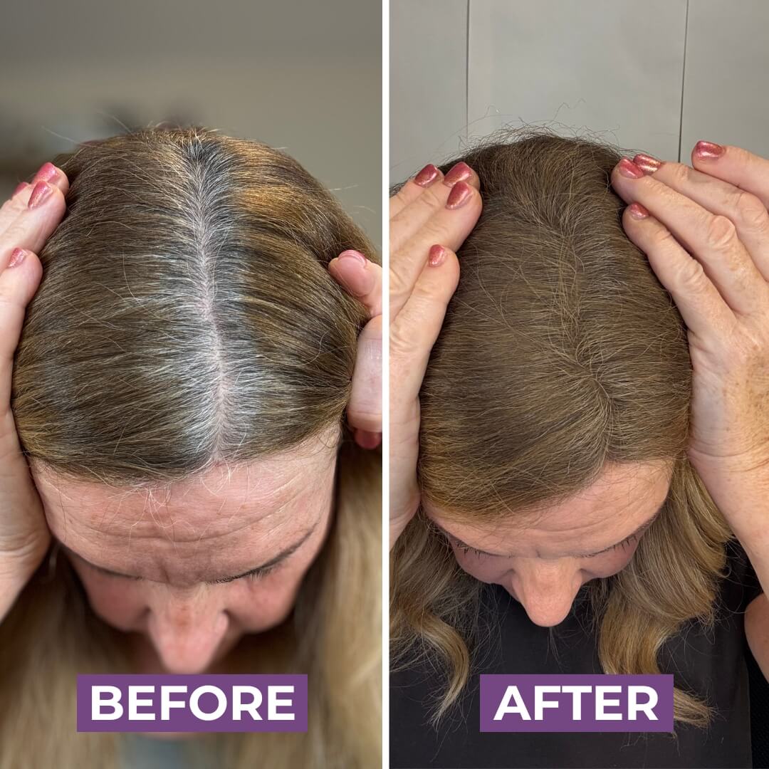 HairMagic+ Hairline Powder - Image 6